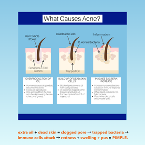 BLACKBELT DEFENCE KIT FOR ACNE AND PIMPLES