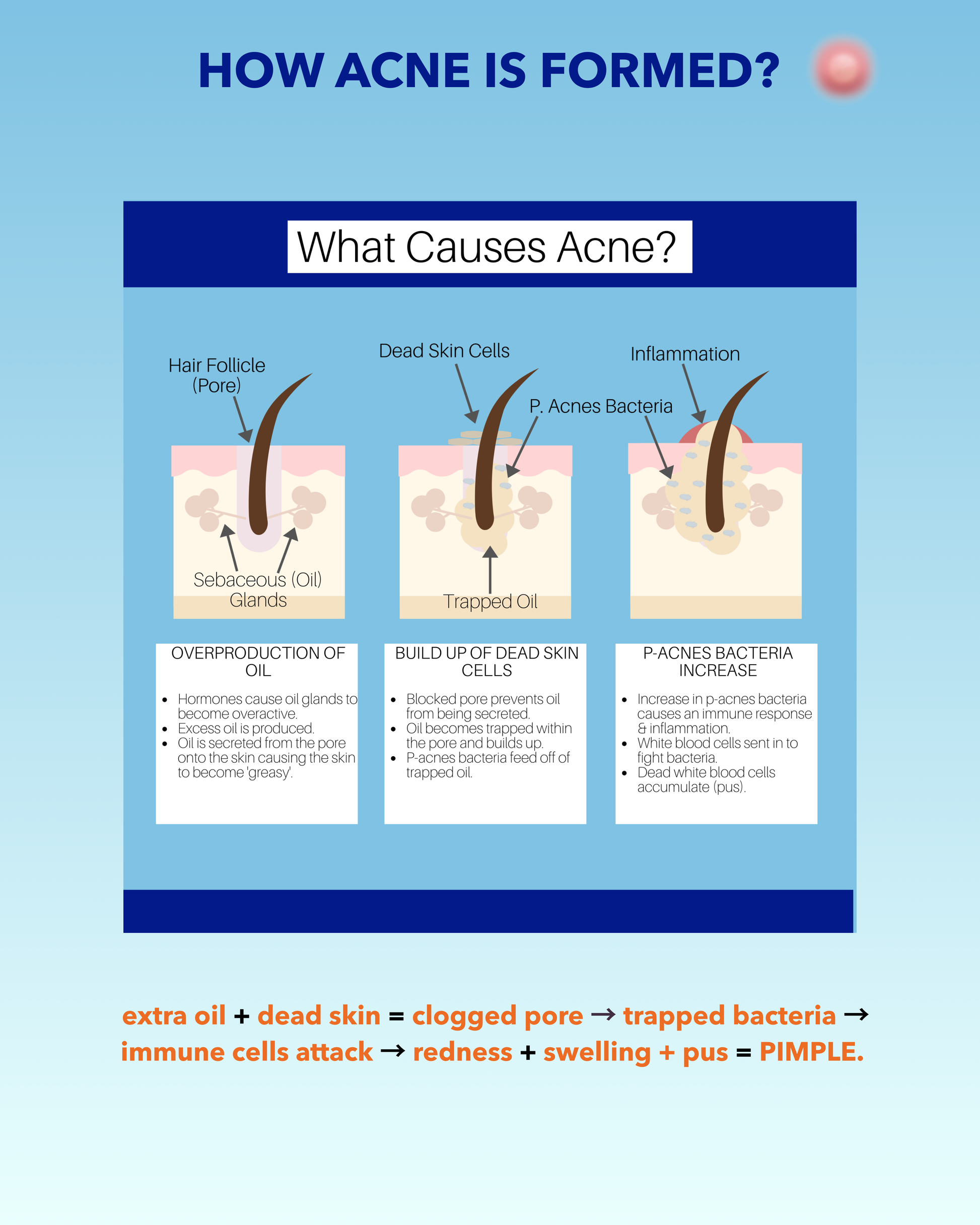 BLACKBELT DEFENCE KIT FOR ACNE AND PIMPLES